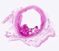 artere bouche