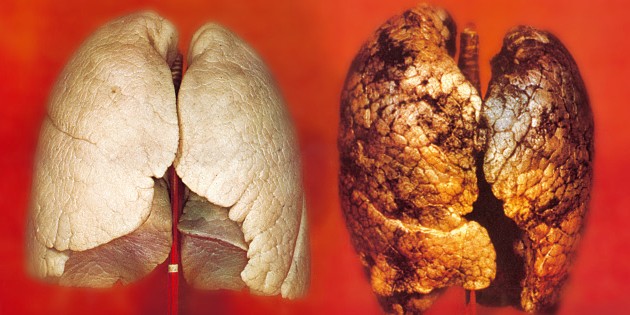 poumons sains et de fumeur